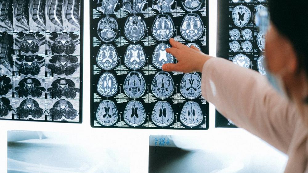 Could this tech be a game-changer for Alzheimer’s diagnosis?