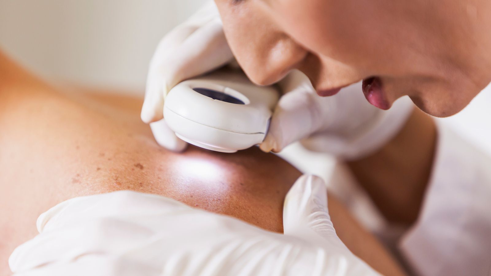 Scientists develop new test that reliably predicts return or spread of deadliest skin cancer