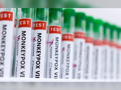 UK Monkeypox Symptoms Different To Prior Outbreaks: Study