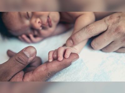 Mitochondrial replacement therapy is a controversial technique used in IVF to help prevent mitochondrial diseases in children by combining the DNA from two parents with healthy mitochondria from a third person
